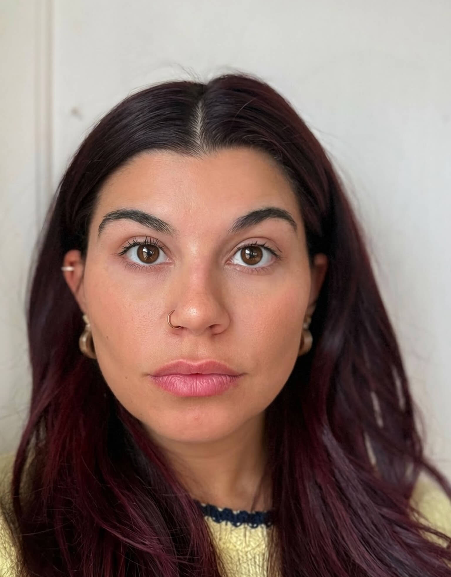 After treatment preview