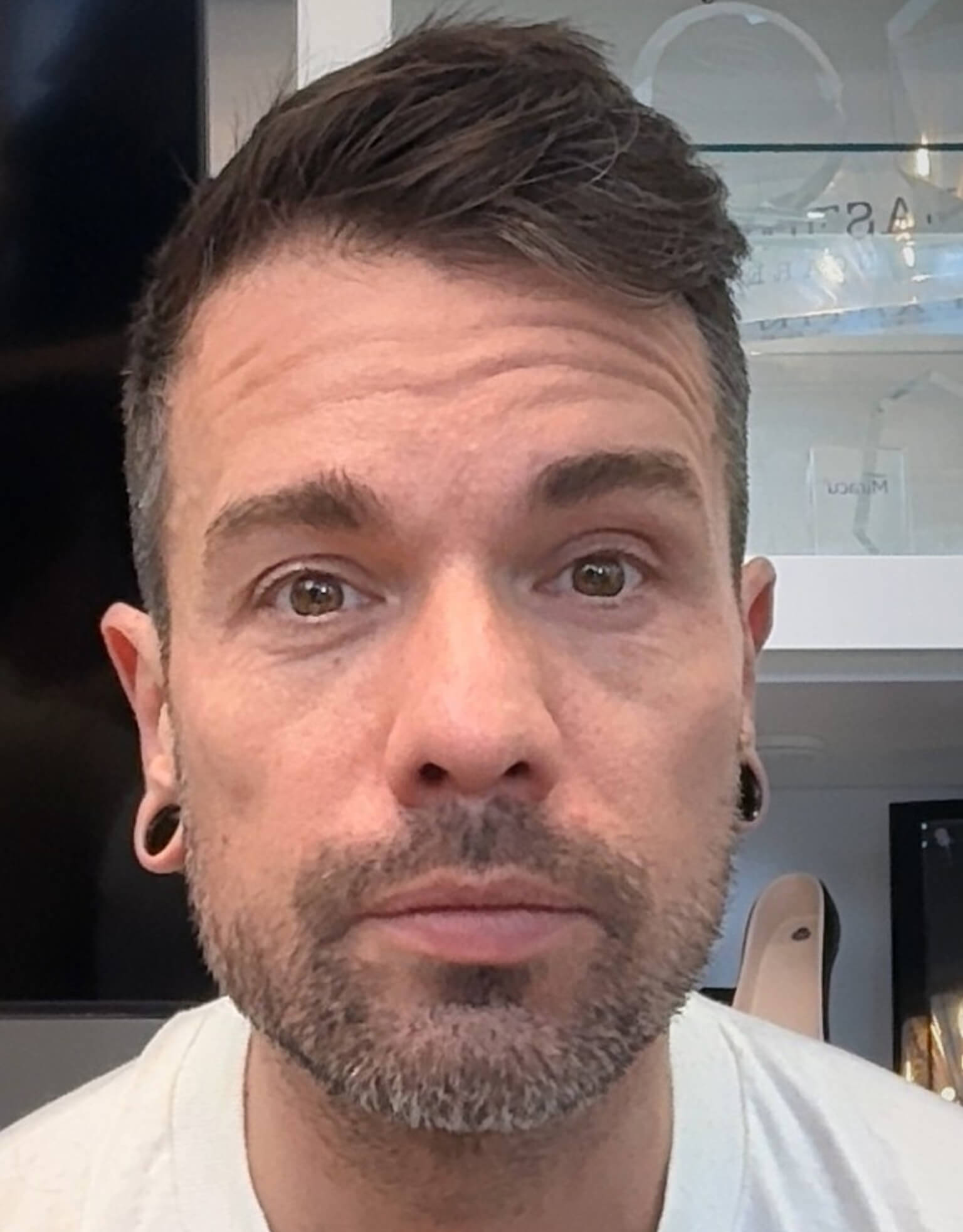 Before treatment preview