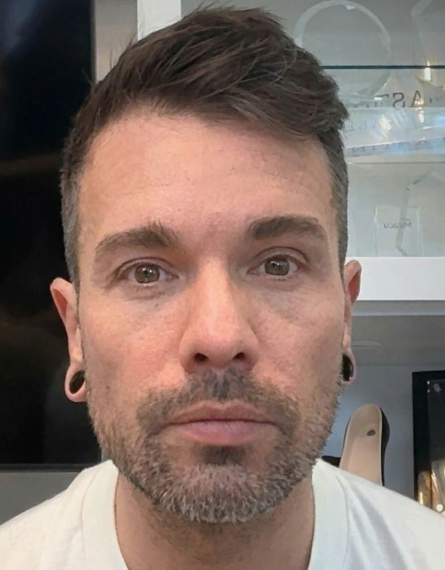 After treatment preview