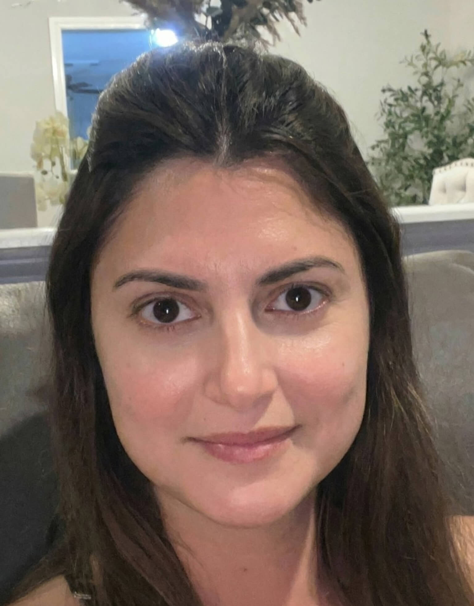 After treatment preview